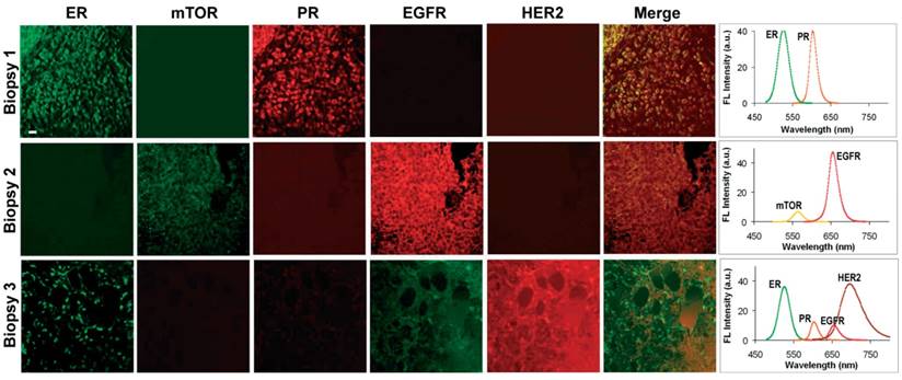 different patterns of nuclear, cytoplasmic and cell membrane